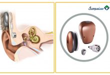 دستگاه‌های شنوایی انتقال استخوانی